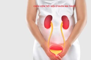 Chữa viêm tiết niệu ở Buôn Ma Thuột